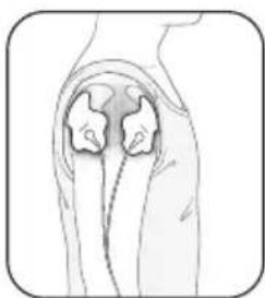 OMRON E3 Intense - Épaule - 3