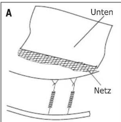 EXIT Supreme Gound Level 214 x 366 cm - SCHRITT 9 - 2