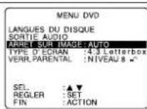 PANASONIC PVD4763SK - Arrêt sur image - 1