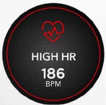 MYKRONOZ ZeRound 3 - RYTHME Cardiaque - 3