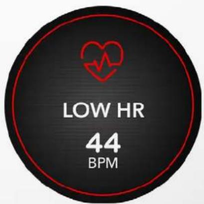MYKRONOZ ZeRound 3 - RYTHME Cardiaque - 4