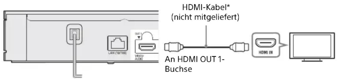 SONY UBPX800M2 - AnschlieBen an Ihr Fernsehgerät - 1