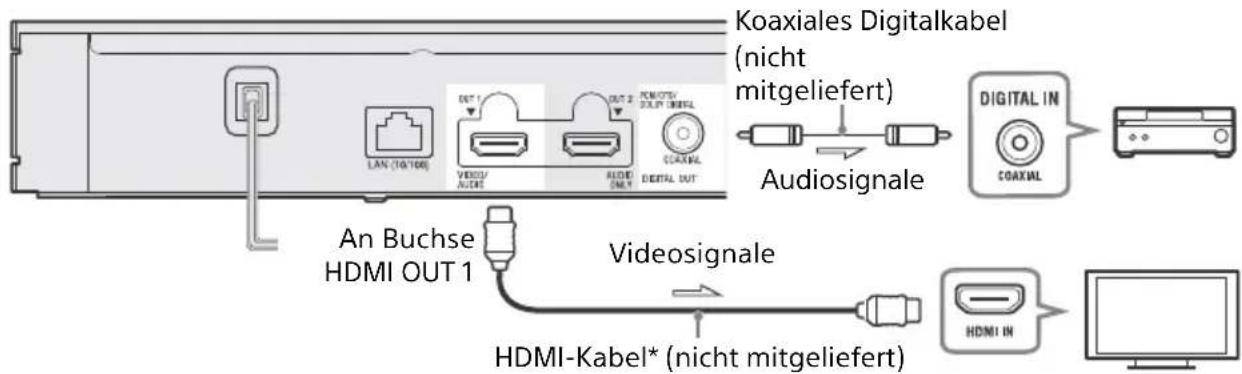 SONY UBPX800M2 - # - 1