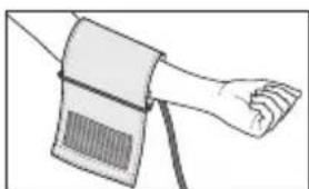 SANITAS SBM 18 - Applicazione del manicotto - 1