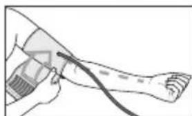 SANITAS SBM 18 - Attaching the cuff - 2