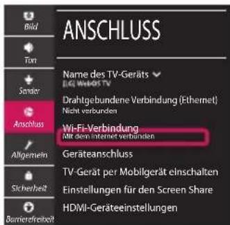 LG 32LM6300PLA - Netzwerkeinstellungen - 4