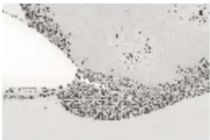 MEDISANA MPS - Safirkägla grovkornig - 2