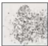 MEDISANA MPS - Coarse-grained sapphire cone - 1