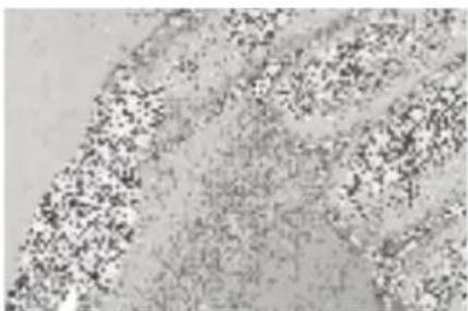 MEDISANA MPS - Cono de fieltro - 2