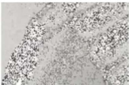 MEDISANA MPS - Cône en feutre - 2