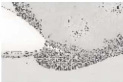 MEDISANA MPS - Karkearakeinen safiirikartio - 2