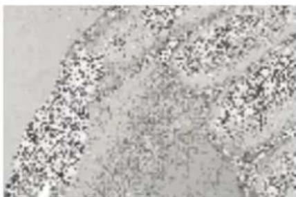 MEDISANA MPS - Hienorakenteinen safiirilevy - 4