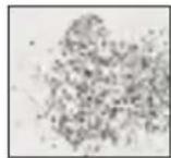 MEDISANA MPS - Tête conique saphir gros grain - 1