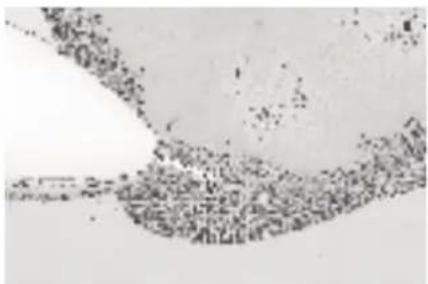 MEDISANA MPS - Coarse-grained sapphire cone - 2