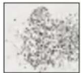 MEDISANA MPS - Saphirkegel grobkörnig - 1