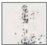 MEDISANA MPS - Fresa a fiamma - 1