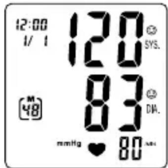 TOPCOM BPM Wrist 7500 BD4627 - Verfahren - 2
