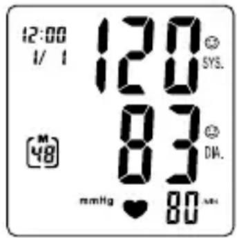TOPCOM BPM Wrist 7500 BD4627 - Procedure - 2