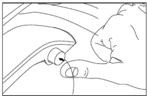 NILFISK Meteor - Soltar e esvaziar o deposito de po - 1