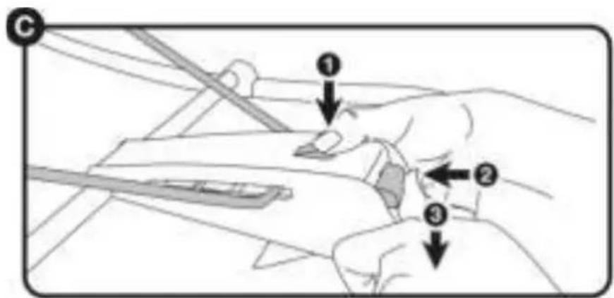 Topmark Indi - Replier. - 4
