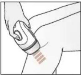 BRAUN Silk·expert Pro 5 PL5124 - Behandlingsmetoder - 2