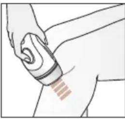 BRAUN Silk·expert Pro 5 PL5124 - Méthodes de traitement - 2