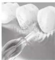 PANASONIC EW1511 - ▶ Gums care - 1