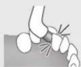 PANASONIC EWDP52 - Misaligned teeth Braces - 1