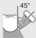 PANASONIC EWDP52 - Periodontal pocket and the boundary between the teeth and gums - 1