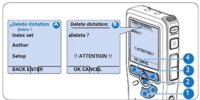 PHILIPS Voice Tracer DVT7110 - Een dictaat verwijderen - 1