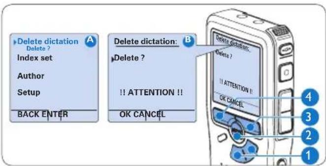 PHILIPS Voice Tracer DVT7110 - 4.4.1 Cancellation di un dettato - 1