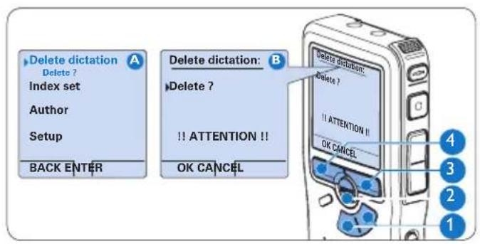 PHILIPS Voice Tracer DVT7110 - Delete a file - 1