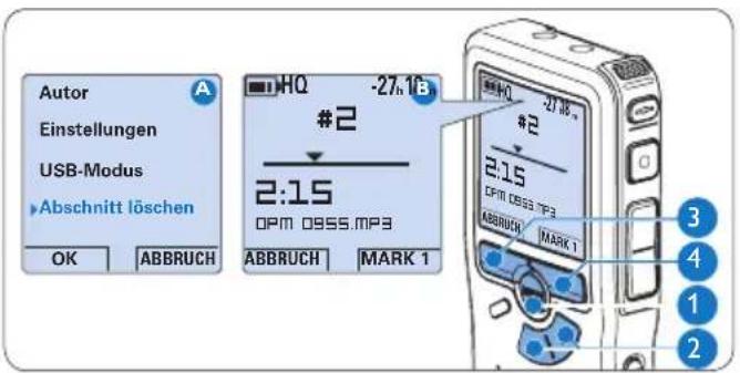 PHILIPS Voice Tracer DVT7110 - Löschen eines Abschnittes innerhalb eines Diktats - 1