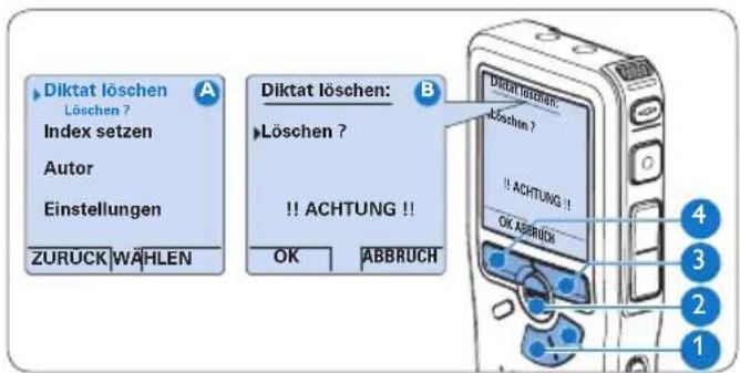 PHILIPS Voice Tracer DVT2810 - Löschen eines Diktats4.4.1 - 1