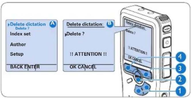 PHILIPS Voice Tracer DVT2810 - 4.4.1 Cancellation di un dettato - 1