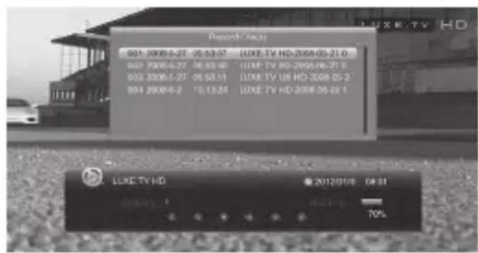 Engel Axil RT0420T2 - Record Manager - 3