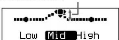SONY DNE320 - Personalización de la calidad del sonido - 3