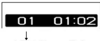 SONY DNE320 - CD audio - 1