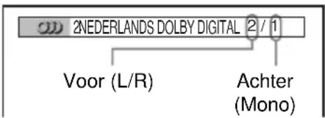 SONY DVPNS590P - Voorbeeld: - 1