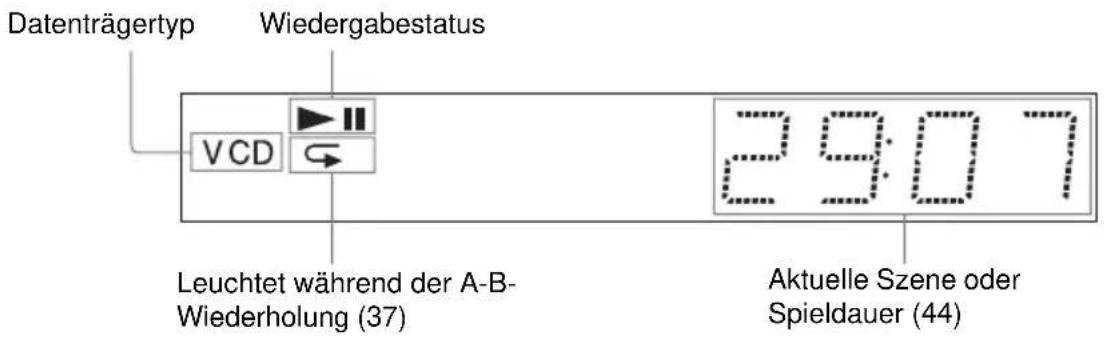 SONY DVPNS590P - Display an der Vorderseite - 2