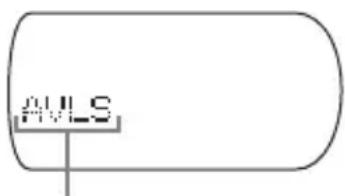 SONY DNS921F - Protection de l'ouïe (AVLS) - 1