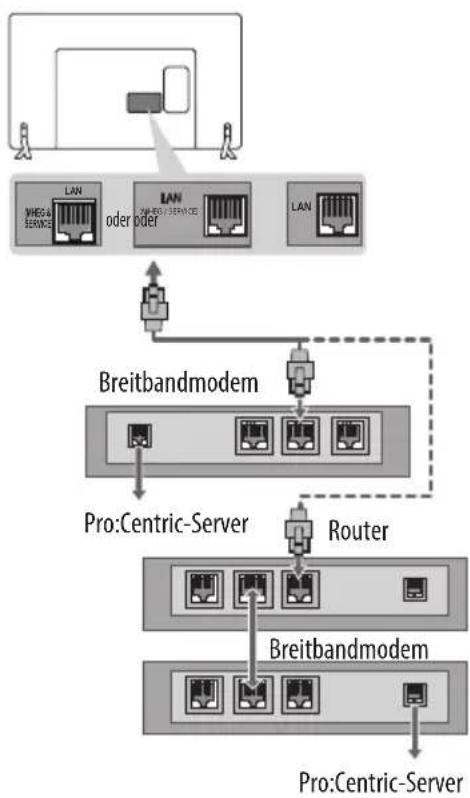 LG 32LX541H - Kabelgebundene Netzwerkverbindung - 1
