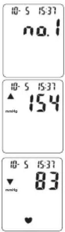TOPCOM BPM ARM 3301 - Procedure - 1