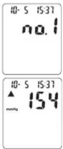 TOPCOM BPM ARM 3301 - Procedure - 1