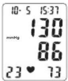 TOPCOM BPM ARM 3301 - Display - 3