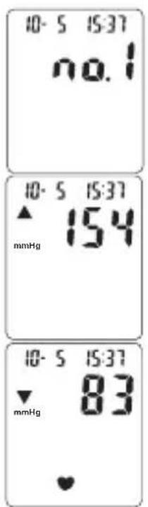 TOPCOM BPM ARM 3301 - Procedure - 1