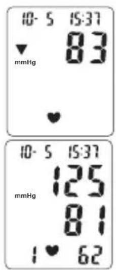 TOPCOM BPM ARM 3301 - Procedure - 2