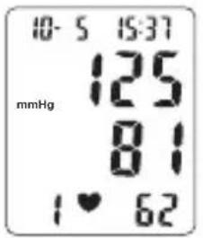 TOPCOM BPM ARM 3301 - Procedure - 2