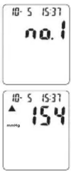 TOPCOM BPM ARM 3301 - Verfahren - 1