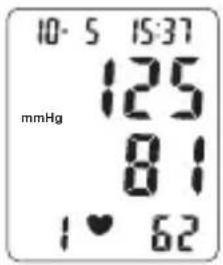 TOPCOM BPM ARM 3301 - Procedure - 2
